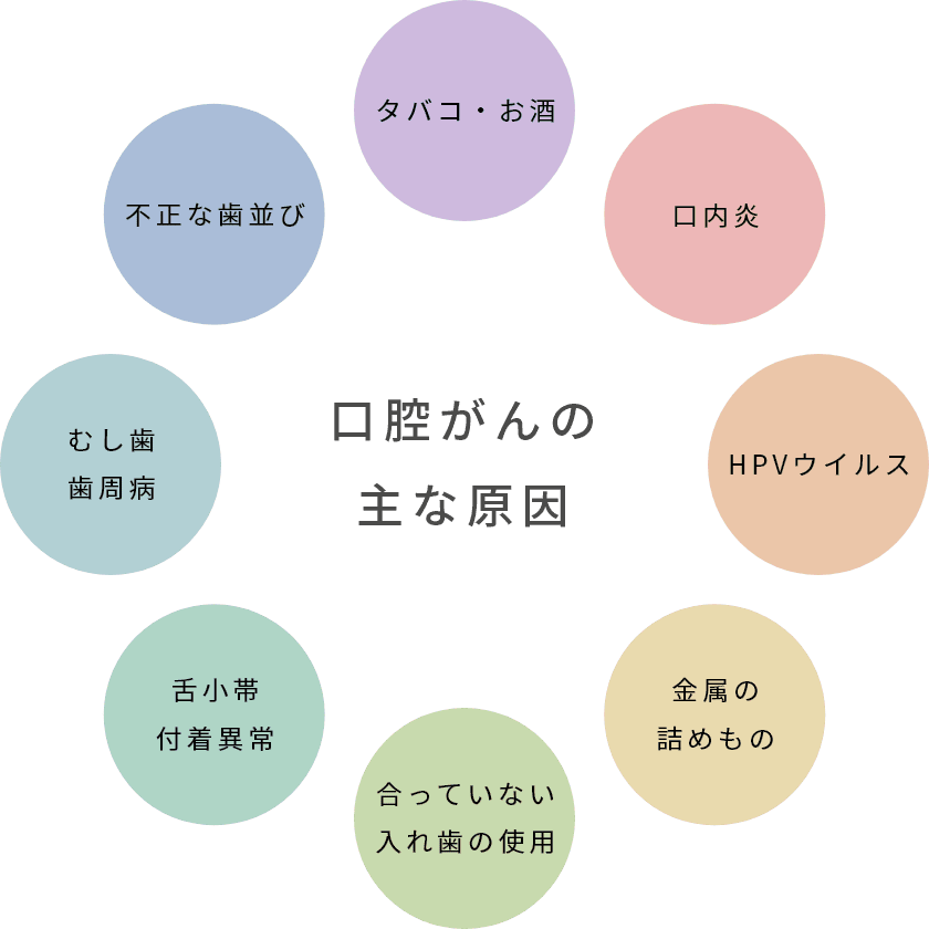 口腔がんの主な原因　タバコ・お酒　口内炎　HPVウイルス　金属の詰めもの　合っていない入れ歯の使用　舌小帯付着異常　むし歯　歯周病　不正な歯並び