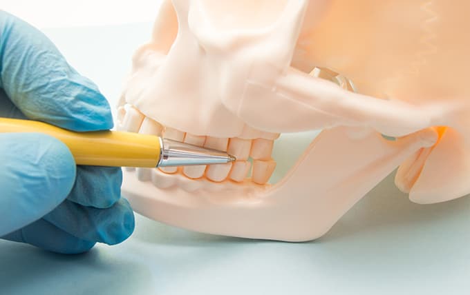 歯科口腔外科とは？のイメージ