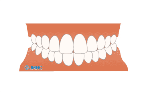 矯正治療で歯並びが整うと…のイメージ