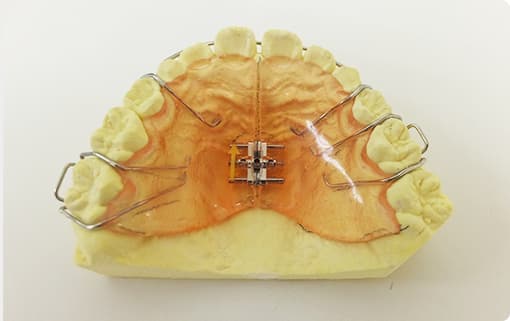 マウスピース型矯正装置