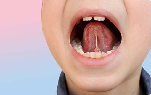 お口回りの筋肉の機能を改善健全な口腔環境を作りますのイメージ
