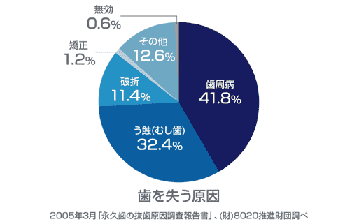 日本人が歯を失う一番の原因のイメージ