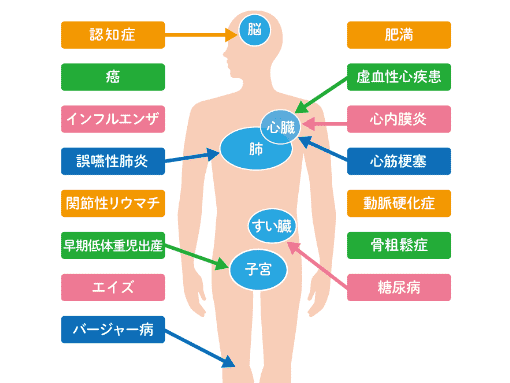 歯周病の恐ろしさのイメージ