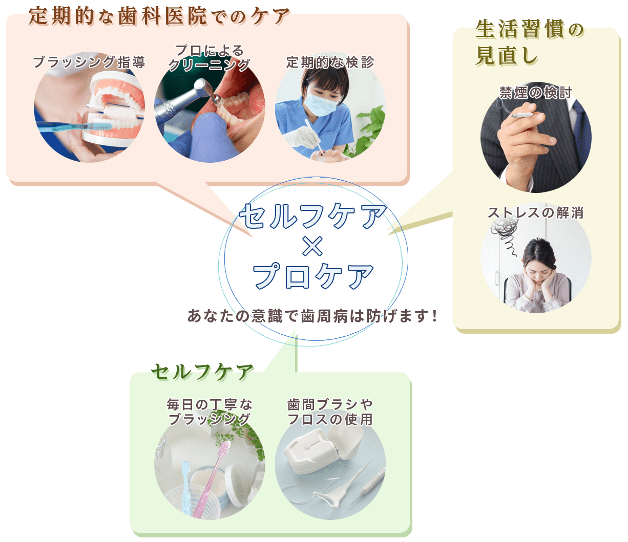 セフルケア×プロケア あなたの意識で歯周病は防げます！ 定期的な歯科医院でのケア ブラッシング指導 プロによるクリーニング 定期的な検診 生活習慣の見直し 禁煙の検討 ストレスの解消 セルフケア 毎日の丁寧なブラッシング 歯間ブラシやフロスの使用