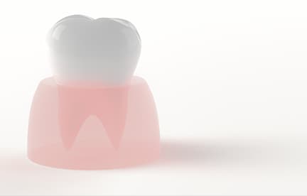 歯質のイメージ